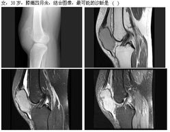 2013年高級衛(wèi)生專業(yè)技術(shù)資格考試放射醫(yī)學(xué)強(qiáng)化練習(xí)題及答案解析（1月30日·放射衛(wèi)生技術(shù)服務(wù)專題）